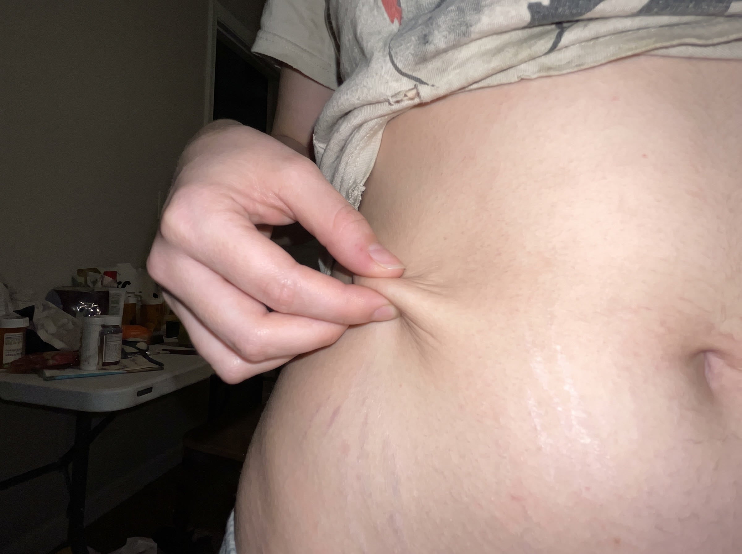 Pinch it. That's not fat