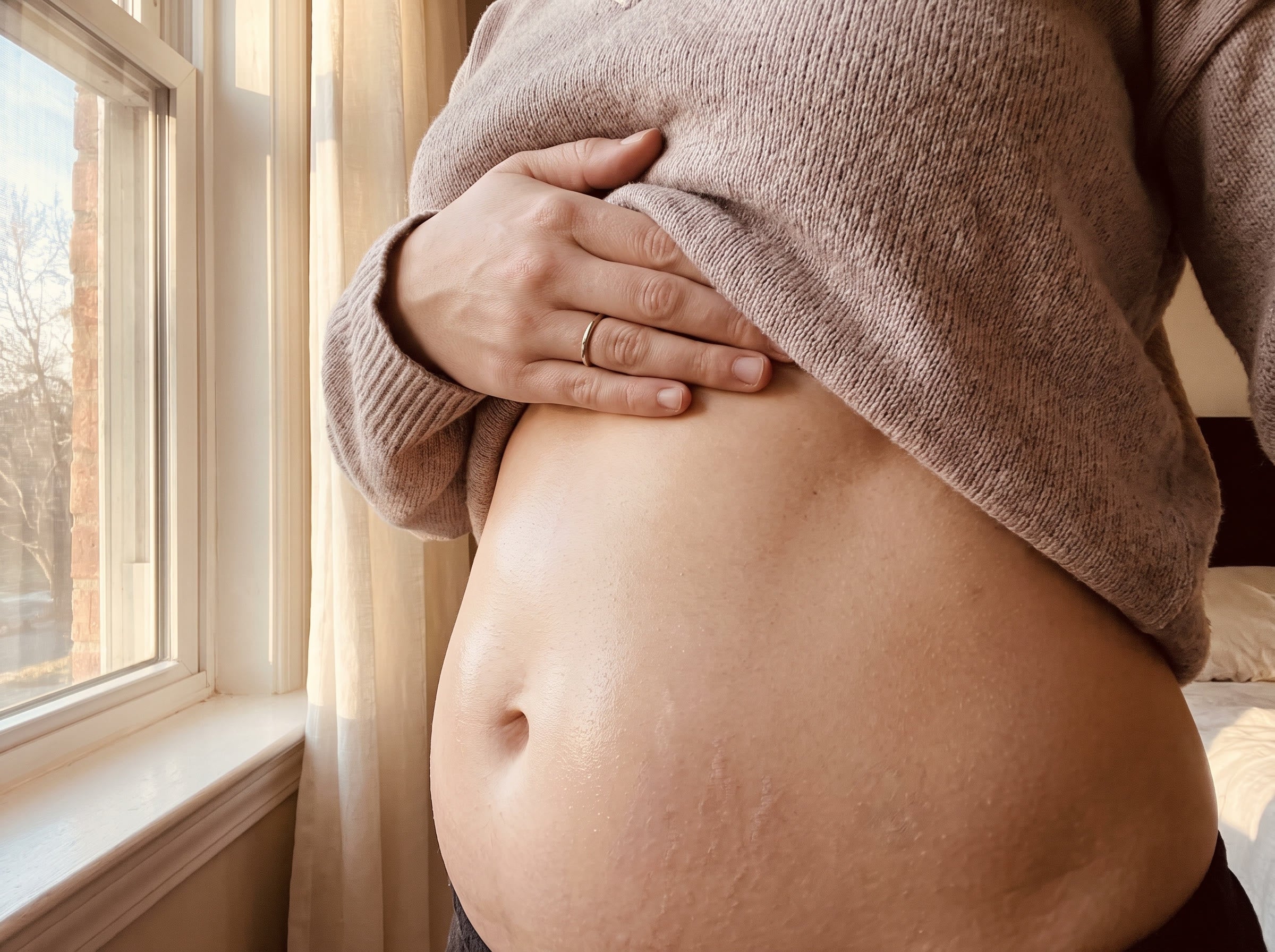 Stretch marks fade their look on boring consistency